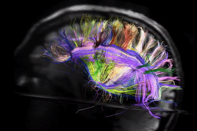 The Brain, As It's Never Been Seen Before